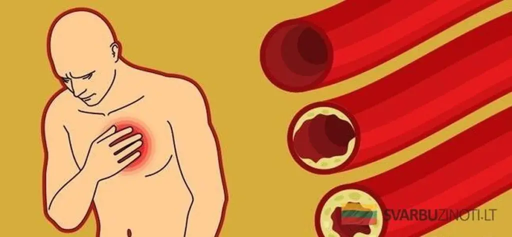 9 potravin, které přirozeně vyčistí vaše tepny