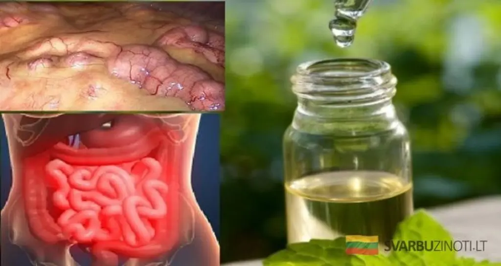 Jak efektivně zbavit tělo toxinů: Domácí recept zvaný "čistič" z jablek a zázvoru